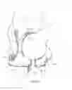 Fig. 03 - BREAST PROTECTIVE GARMENT