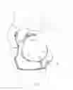 Fig. 06 - BREAST PROTECTIVE GARMENT