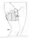 Fig. 04 - Thigh mounted holder