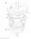 Fig. 01 - SINGLE USE BEVERAGE FILTER BASKET WITH NON-WOVEN FILTER MEDIUM