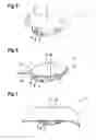 Fig. 04 - Washing device