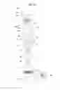 Fig. 09 - Robot cleaner