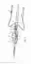 Fig. 02 - MEDICAL DEVICE INTRODUCTION AND IMAGING SYSTEM, AND ASSOCIATED METHOD