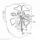 Fig. 01 - Apparatus and method to illuminate and orient guidewire
