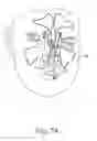 Fig. 06 - Apparatus and method to illuminate and orient guidewire