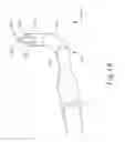 Fig. 20 - Apparatus and method to illuminate and orient guidewire