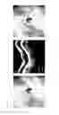 Fig. 07 - Systems and methods of glaucoma diagnosis based on frequency analysis of inner retinal surface profile measured by optical coherence tomography