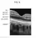 Fig. 07 - Ophthalmic apparatus, information processing method, and storage medium