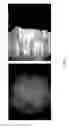 Fig. 05 - Minimally invasive wireless sensing devices and methods