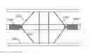 Fig. 01 - CATHETER COMPRISING TWO OPTICAL SENSORS