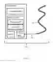 Fig. 06 - CATHETER COMPRISING TWO OPTICAL SENSORS