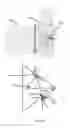 Fig. 11 - CATHETER COMPRISING TWO OPTICAL SENSORS
