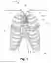 Fig. 02 - Device and system for determining physiological parameters from the sternum bone