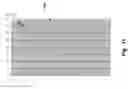 Fig. 12 - Device and system for determining physiological parameters from the sternum bone