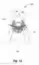 Fig. 13 - Device and system for determining physiological parameters from the sternum bone