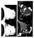 Fig. 04 - Methods, systems, and apparatus for identification, characterization, and treatment of rotors associated with fibrillation