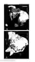 Fig. 05 - Methods, systems, and apparatus for identification, characterization, and treatment of rotors associated with fibrillation