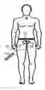 Fig. 01 - DEVICE, SYSTEM AND METHOD FOR INTRAVESICAL URODYNAMIC ANALYSIS