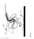Fig. 09 - DEVICE, SYSTEM AND METHOD FOR INTRAVESICAL URODYNAMIC ANALYSIS