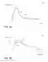Fig. 06 - Detection and evaluation of user grip with a handheld tool