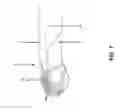 Fig. 08 - THERAPEUTIC AGENT DELIVERING BIOPSY NEEDLE DEVICE AND METHOD OF USE