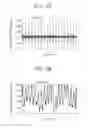 Fig. 03 - Bio-information detecting apparatus