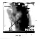 Fig. 06 - Systems and methods of image acquisition for surgical instrument reconstruction