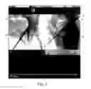 Fig. 07 - Systems and methods of image acquisition for surgical instrument reconstruction