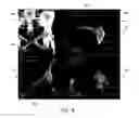 Fig. 08 - Systems and methods of image acquisition for surgical instrument reconstruction