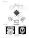 Fig. 02 - Apparatus and method for reconstructing tomography images using motion information