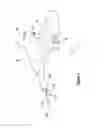Fig. 02 - Tissue excision device with anchor stability rod and anchor stability rod