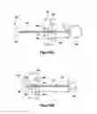 Fig. 31 - Tissue excision device with anchor stability rod and anchor stability rod