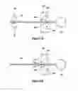 Fig. 33 - Tissue excision device with anchor stability rod and anchor stability rod