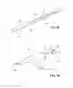 Fig. 38 - Tissue excision device with anchor stability rod and anchor stability rod