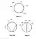 Fig. 23 - TISSUE EXCISION DEVICE WITH EXPANDING CANNULA AND EXPANDING CANNULA