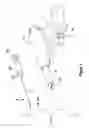 Fig. 04 - INCISION EXPANSION INTRODUCER