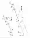 Fig. 05 - INCISION EXPANSION INTRODUCER