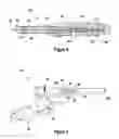 Fig. 08 - INCISION EXPANSION INTRODUCER