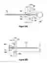 Fig. 32 - INCISION EXPANSION INTRODUCER