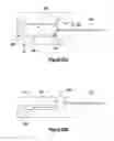 Fig. 34 - INCISION EXPANSION INTRODUCER