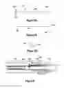 Fig. 16 - BREAST COMPRESSION DEVICE