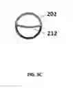 Fig. 16 - WOUND RETRACTORS WITH NON-CIRCULAR, NON-COPLANAR OR NON-PARALLEL INNER RINGS