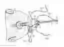 Fig. 01 - Devices, systems, and methods for suture management