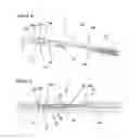 Fig. 04 - Needle-suture combination