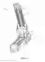 Fig. 03 - Surgical stapler buttress applicator with multi-point actuated release mechanism