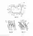 Fig. 35 - Medicant eluting adjuncts and methods of using medicant eluting adjuncts