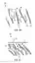 Fig. 10 - Adjunct material to provide heterogeneous drug elution