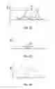 Fig. 17 - Adjunct material to provide heterogeneous drug elution