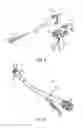 Fig. 04 - Tubular surgical constructs including adjunct material