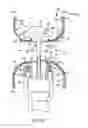 Fig. 20 - Tubular surgical constructs including adjunct material